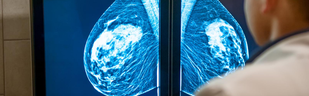 Breast screening x-ray images